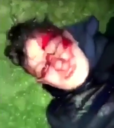Irlande : Garçon poignardé dans un parc par des Noirs